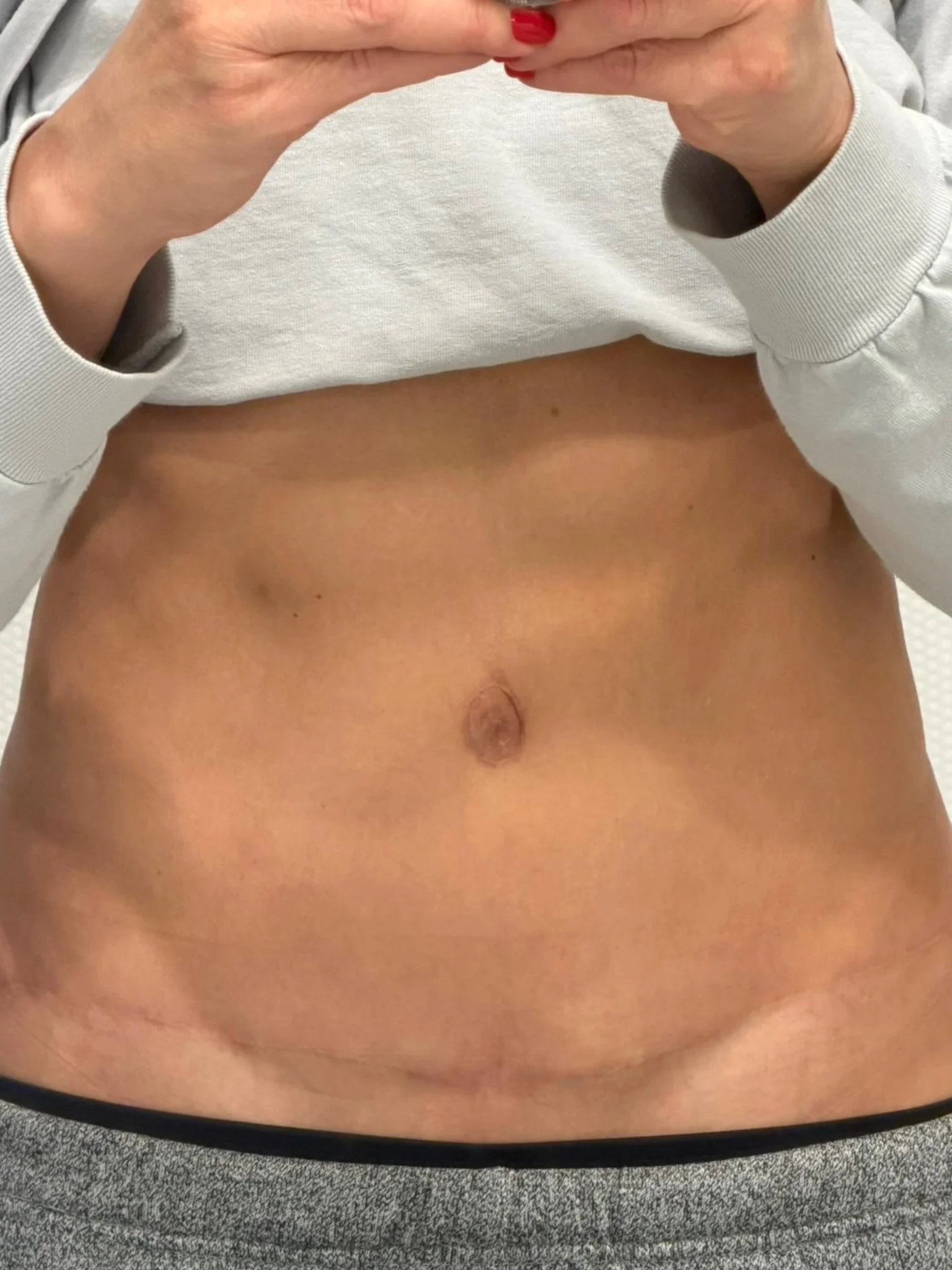 Paramedical Tattoos After