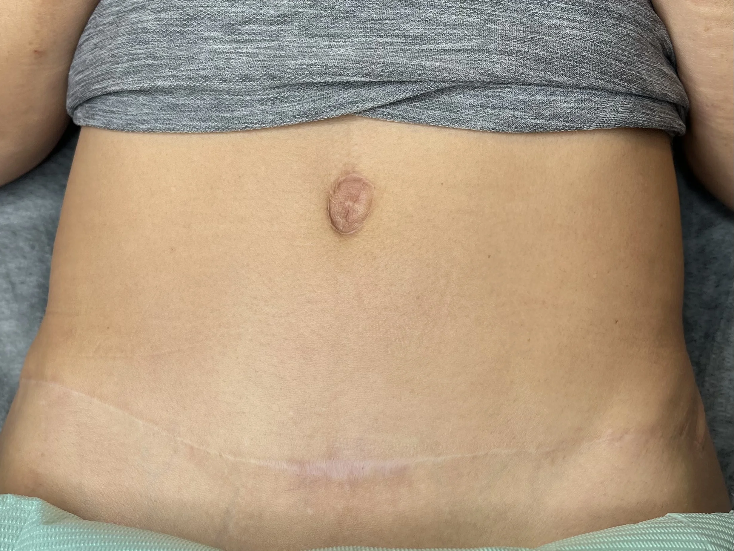 Paramedical Tattoos Before