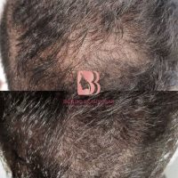 9276F7B7-D478-443C-B726-5E60B684D58E Skincare Treatments, Bonito Beauty Bar